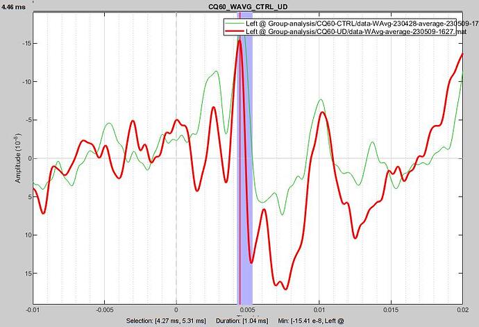 Group_analysis_@intra_CQ60_WAVG_CTRL_UD