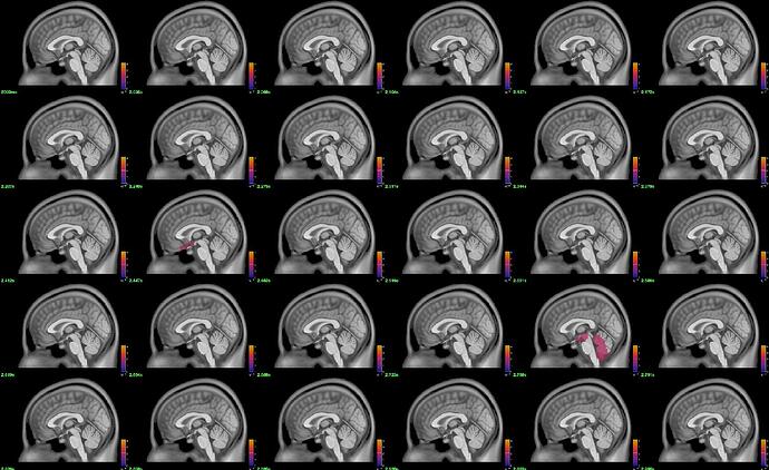 sagittal