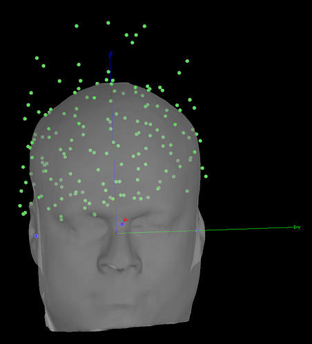 MRI_EEG