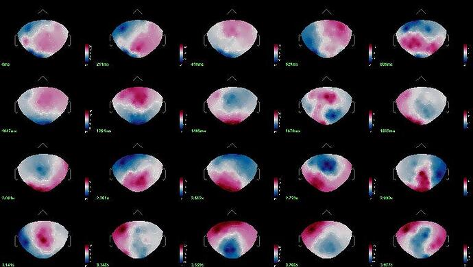 Contact_sheet__EEG_TP_sepi01_%40rawtutorial_eeg_band_33