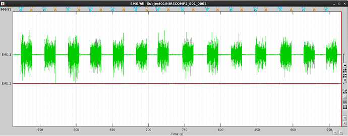 signal_emg