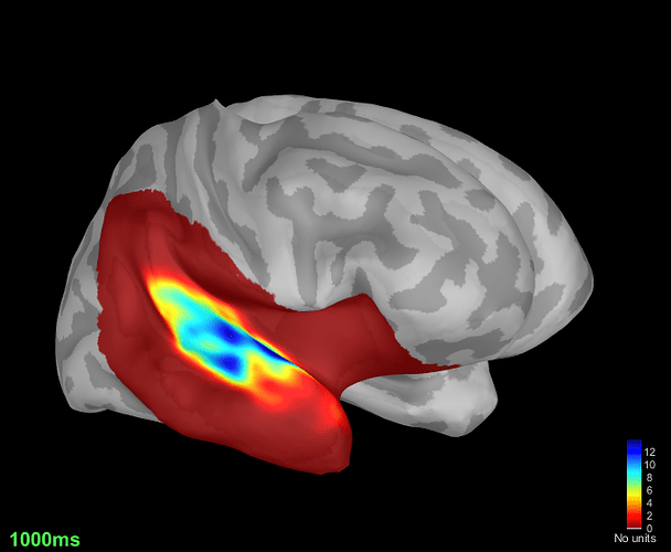 ADC_V_3D_Subject01_01_Subject01-01_AEF_20150112_04_2400_notch_band_02_clean_S1D1_smooth_take8-M100-peak-GAUSSIAN_filtered__abs__ssmooth1