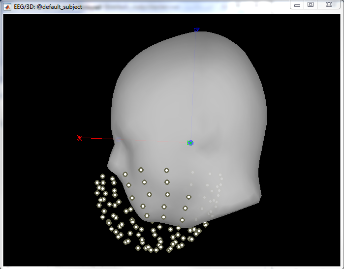 Problems with registering EEG electrodes versions 05-Feb-2016 and most ...