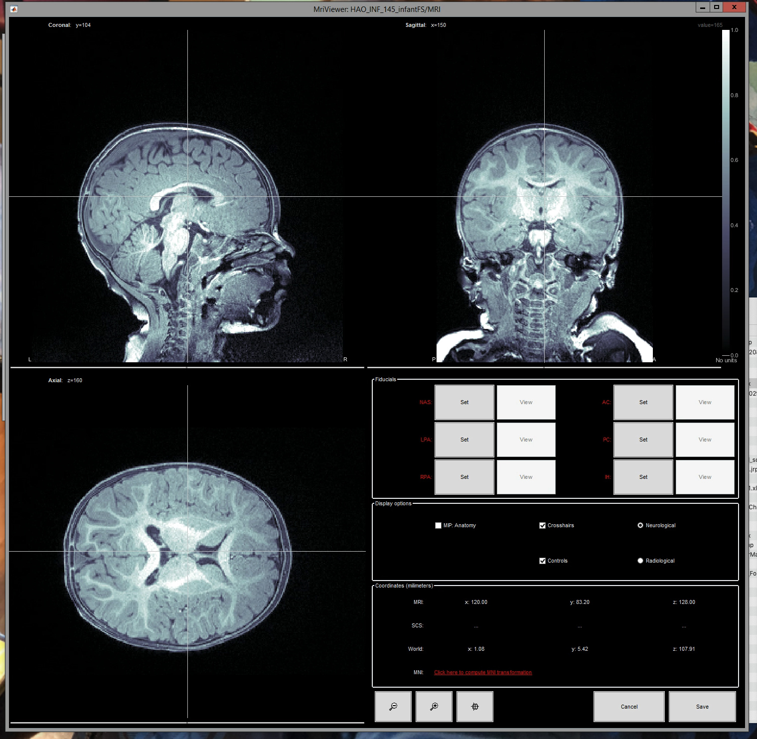 Tilt Correction with the Gerd Neumann CTU — AstroWorldCreations