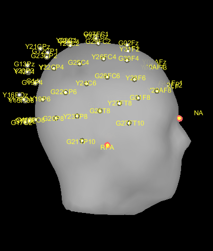 EEG_3D_02
