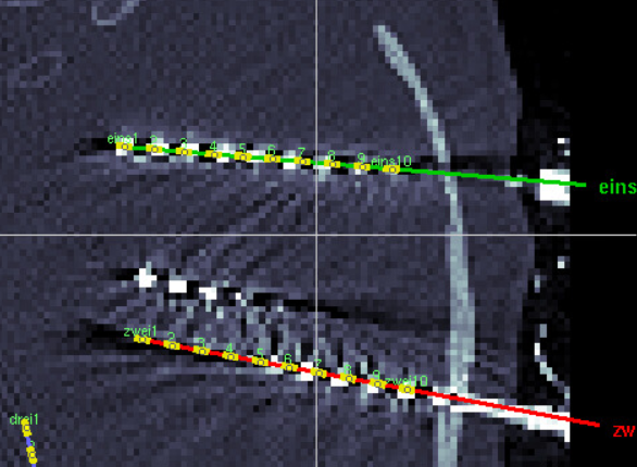 computed Electrodes