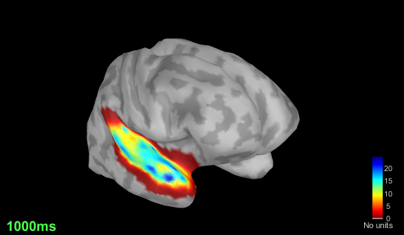 MEG_3D_Subject01_01_Subject01-01_AEF_20150112_04_2400_notch_band_02_clean_S1D1_smooth_take8-M100-peak-GAUSSIAN__cortex_15002V__abs__ssmooth3