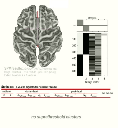 sbm_result