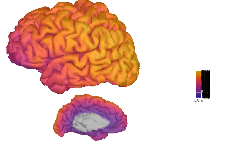 Invalid Scale in 2d map - Brainstorm