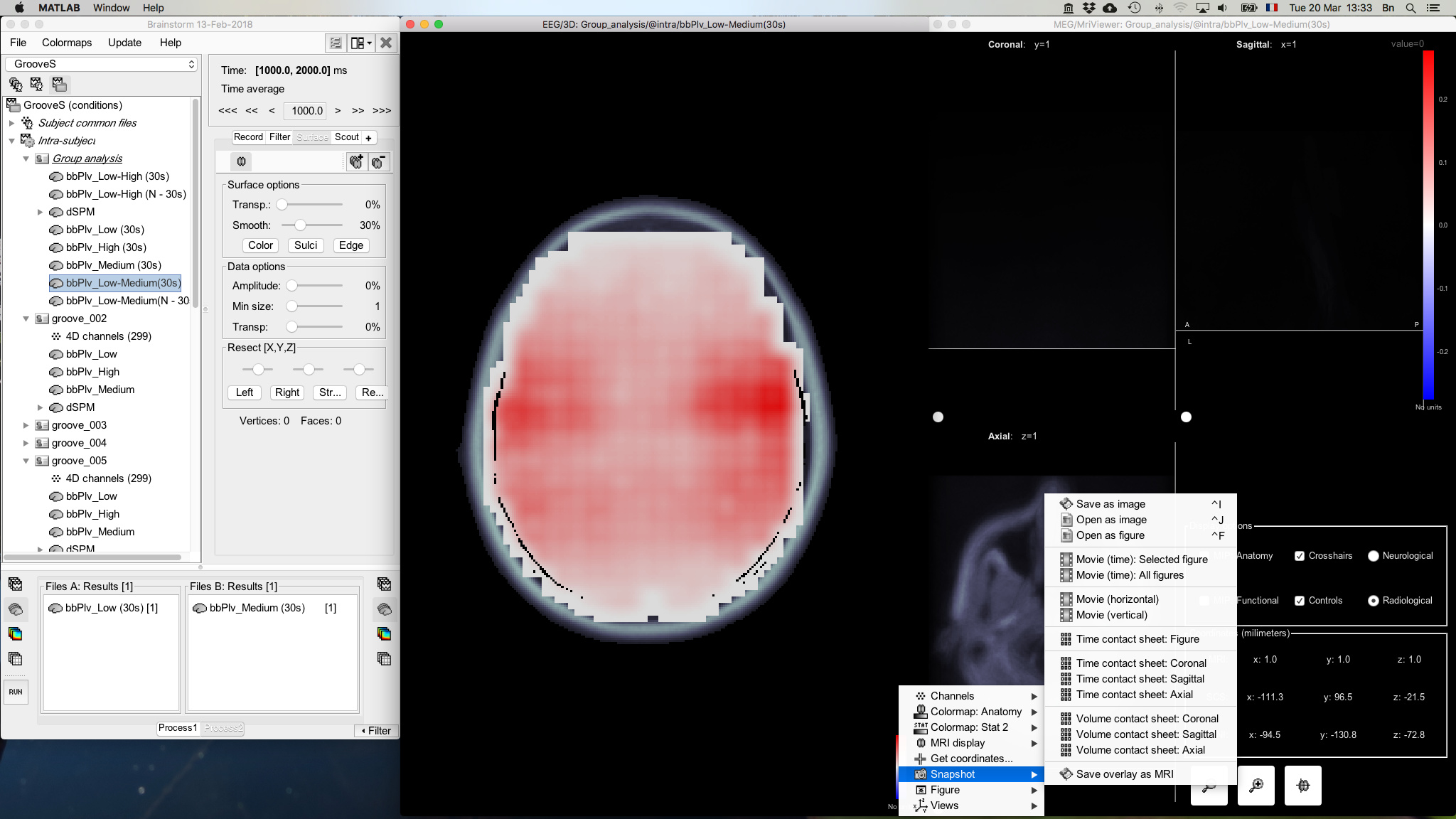 mri viewer mac