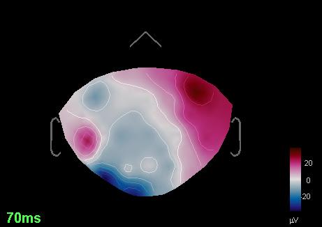 EEG_TP_sepi01_%40rawtutorial_eeg_band