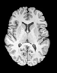 mri_brain_2.jpg