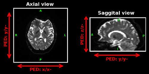 IPED_ped_eg_small.png