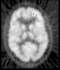 Molecular Imaging