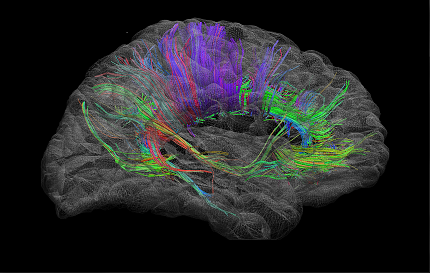 Molecular Imaging