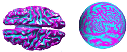 http://neuroimage.usc.edu/neuro/Image Analysis